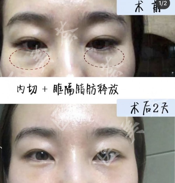 attachments-2021-06-Xjh78U8860b59ac6e612e.jpeg