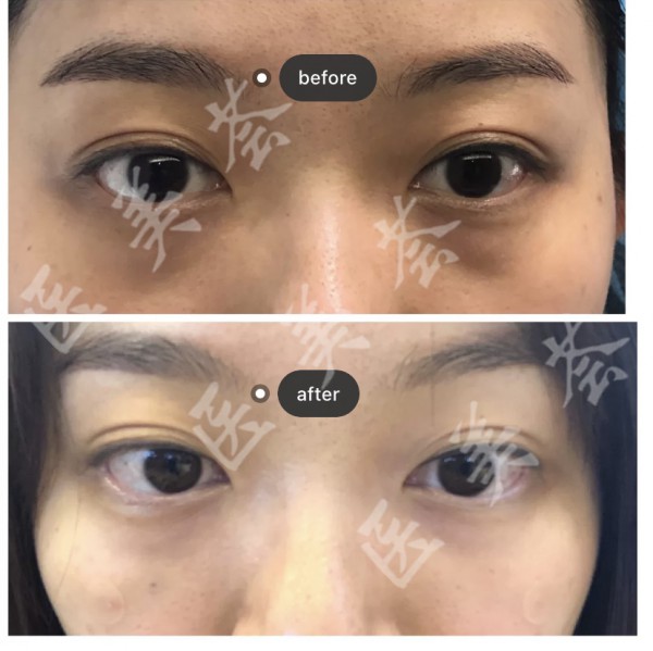attachments-2021-07-KEwwgYji6102991dd2490.jpeg