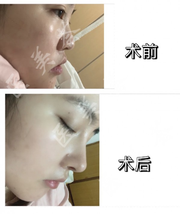 attachments-2021-07-VLgZ5Ljl60ea5302568bc.jpeg