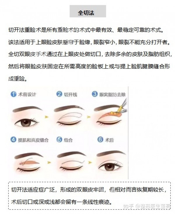 attachments-2021-07-c9MC8tB160f0ec4c4ead9.jpeg