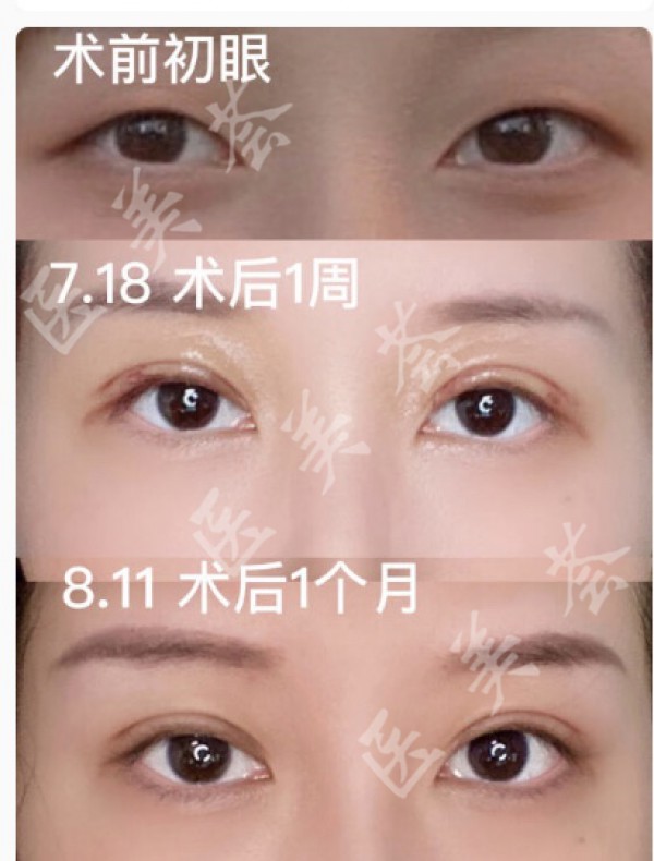attachments-2021-07-rKNtPCRz61052105994d9.jpeg