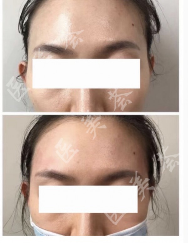 attachments-2021-08-EXmPVwHB611a3c81555a9.jpeg