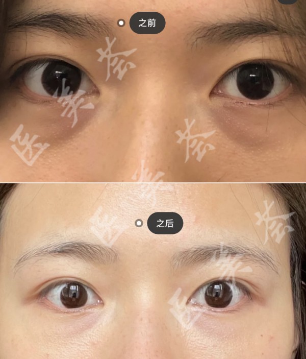 attachments-2021-08-Rm5x6Qga611f84fd4bd12.jpeg