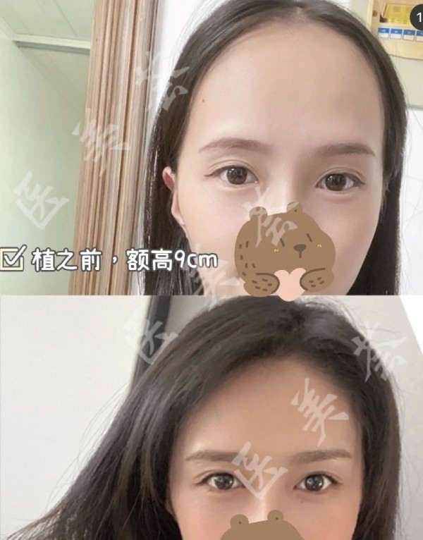 attachments-2021-08-UsAw63696123b7139c671.jpeg