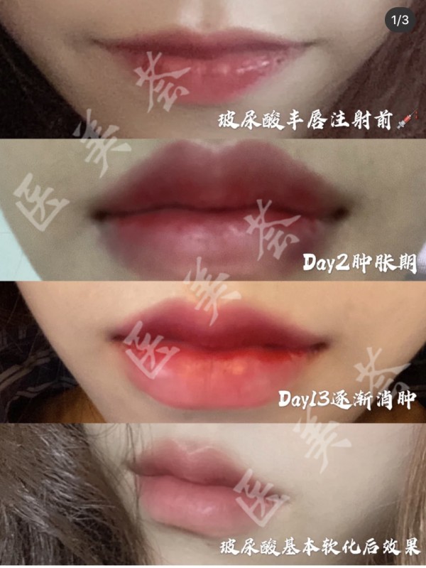 attachments-2021-08-gfEbI1cb610d2145b9034.jpeg