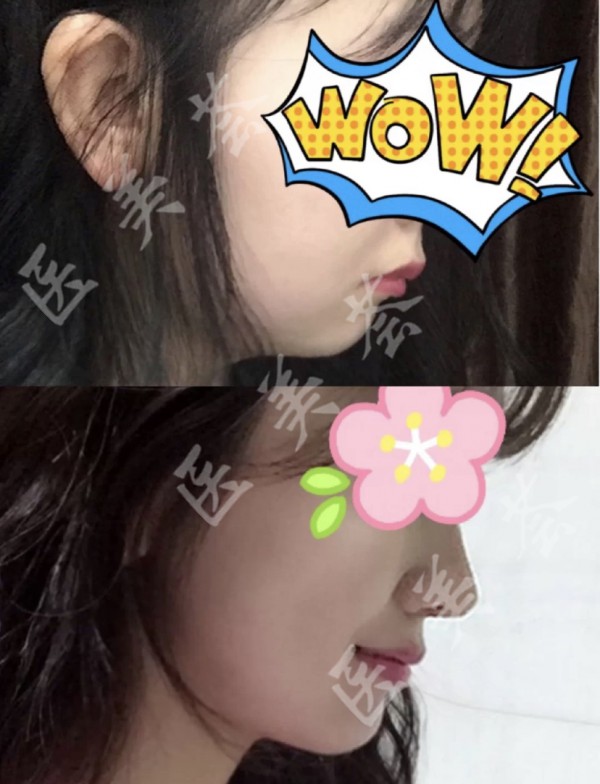 attachments-2021-08-lSFSy1mH61299dafee2e1.jpeg