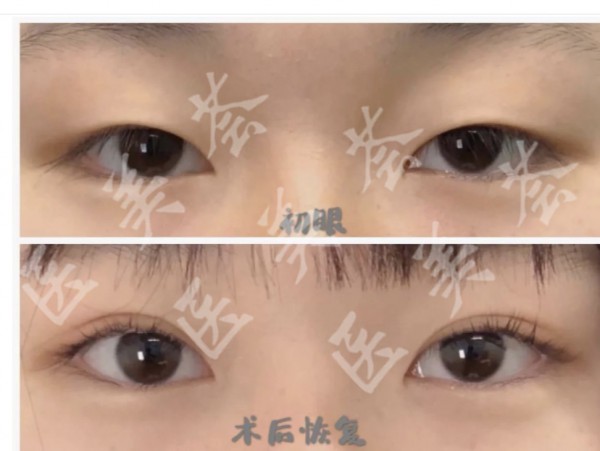 attachments-2021-08-nk9WdMUi6126f79918519.jpeg