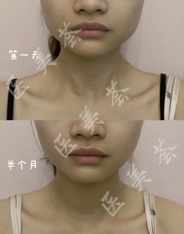 attachments-2021-08-tTmIHKJ561149e198ac27.jpeg