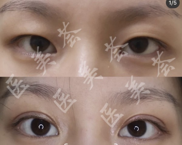 attachments-2021-08-w1sAzudx611cd799eb14a.jpeg