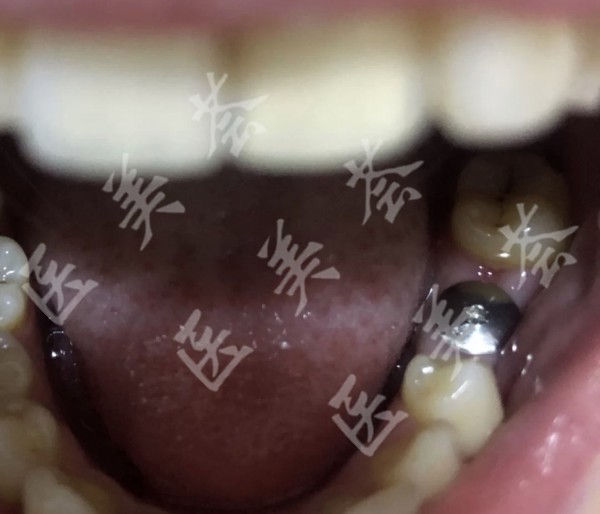 attachments-2021-09-rLkjsOxL61318db973650.jpeg