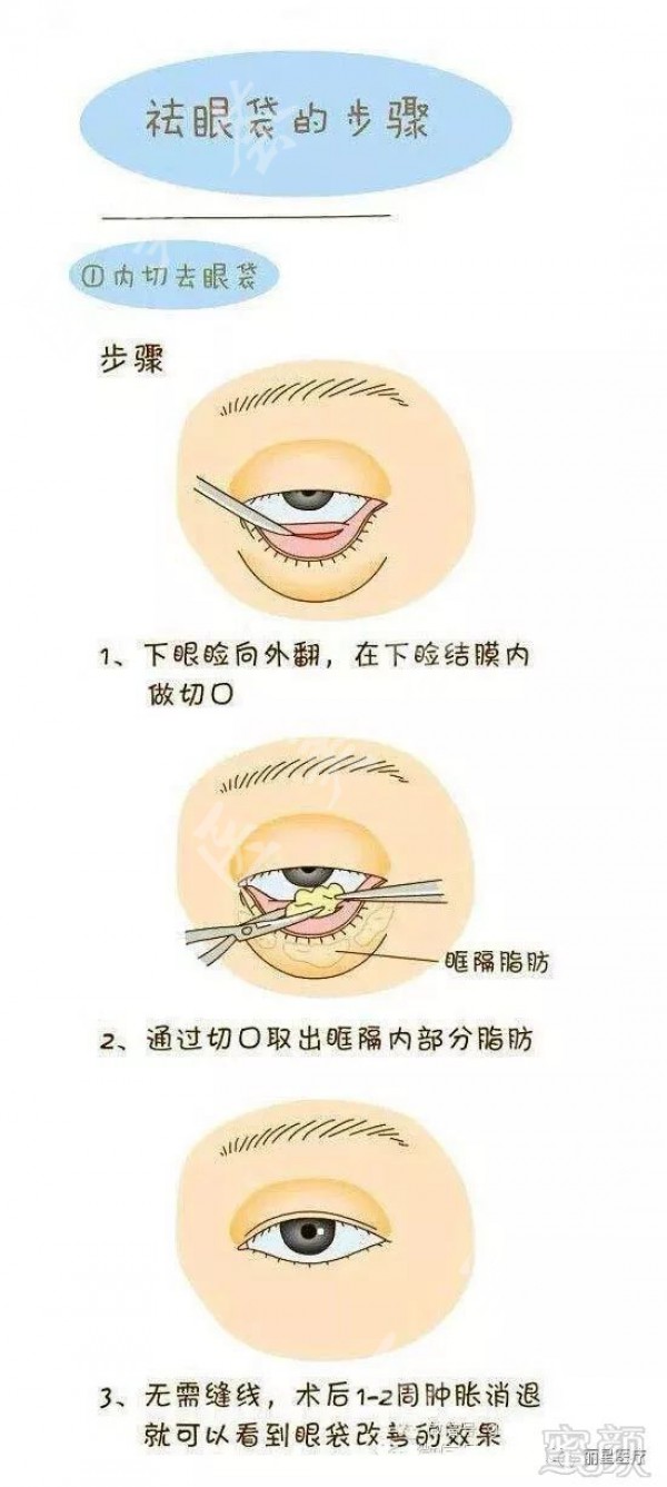attachments-2021-10-2jOUEJO761699981202fb.jpeg