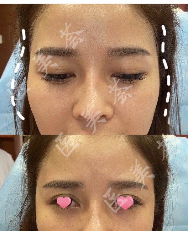 attachments-2021-10-rcbvgJrQ6178f54e7327f.jpeg