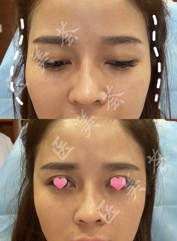 attachments-2021-11-VNCH65cn618ceb9f230c2.jpeg