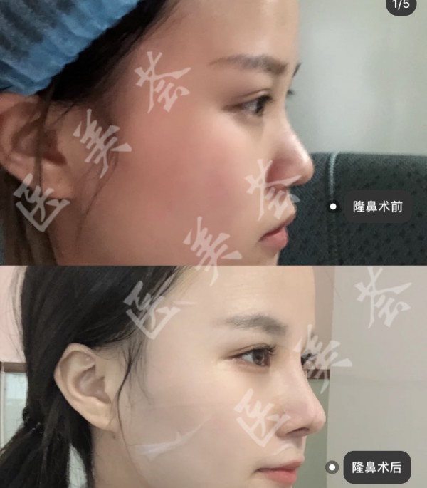 attachments-2021-11-hNfyPWKo61a32a4f496ed.jpeg
