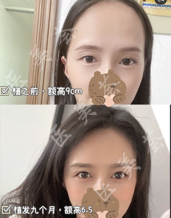 attachments-2021-11-kUoRCTFY61a58dff45613.jpeg